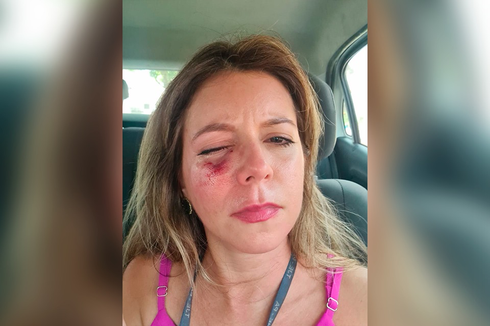 OFICIALA DE JUSTIÇA SOFRE GRAVES AGRESSÕES DURANTE CUMPRIMENTO DE MANDADO NO PARÁ